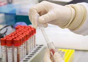 test tube being held in a lab