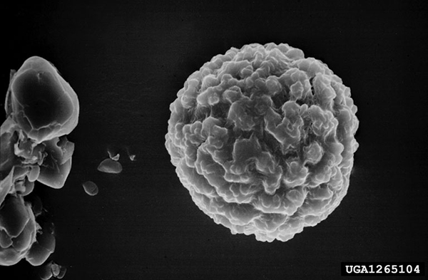 magnified round spore with uneven surface